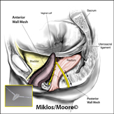 Groin and buttocks pain